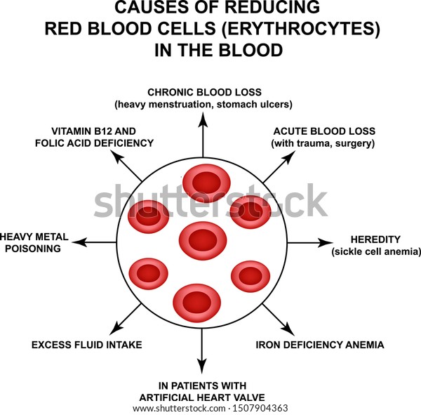 Causes Reducing Red Blood Cells Cells Stock Vector Royalty