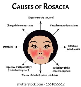 Causes of rosacea. Rosacea Awareness Month. Infographics. Vector illustration on isolated background.