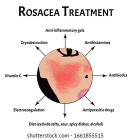 Causes of rosacea. Rosacea Awareness Month. Infographics. Vector illustration on isolated background.