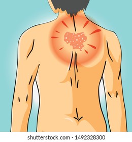 Causes of skin Itching on back vector illustrator