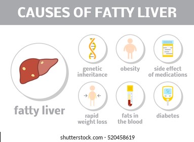 Causes of steatosis. Vector elements in flat style for liver disease infographic