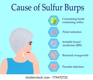 Causes of Sulfur Burps vector illustration