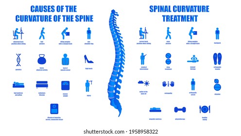 Causes and treatment of scoliosis. Infographics on the topic of posture disorders. Icons denoting curvature of the spine and methods of preventing back diseases. Medical educational poster.