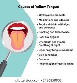 Causes of yellow tongue, medical information 