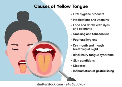 Causes of yellow tongue, medical information 