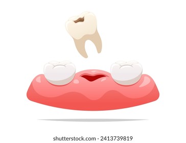 Las cavidades son retiradas de las encías. Concepto de salud dental. Ilustración vectorial.