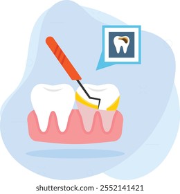 Concepto de caries o caries dental, eliminación del cálculo, diseño de íconos de color de Vector tártaro, símbolo de odontología, signo de atención médica, stock de instrumentos dentales, superficie áspera y endurecida formada en la ilustración de dientes