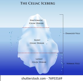 Celiac disease Iceberg. Symptomatic, Silent and Latent celiac disease.