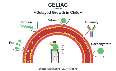 Celiac Disease Makes A Delayed Growth In Child. Immune System Attacks Small Intestine And Inhibits Absorption Of Important Nutrients, Such As Fat, Protein,vitamin And Carbohydrates, Into The Body.