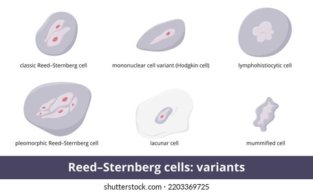 Células Reed-Sternberg. Seis variantes: células clásicas, mononucleares o células Hodgkin, lacunar, momificadas y anplásicas, predominantes (células LP).