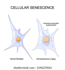 Senescencia celular. cambios en las células senescentes Durante el envejecimiento. Comparación y diferencia entre fibroblasto normal y sensibilidad celular en el envejecimiento. Senescencia asociada
β-galactosidasa. Ilustración del vector