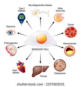 Cellular Senescence and health risks. roles that senescent cells play in the human body. biological clock, Aging problems, Cancer, Injury and Disease. Vector poster