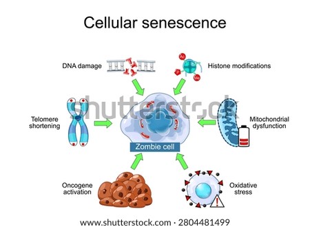 Cellular senescence. Zombie cell and Causes of premature aging factors. Hallmarks of ageing. Anti-aging therapy. Anti aging medicine. Education illustration. Vector Medical infographic diagram