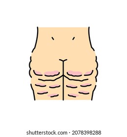 Cellulite color line icon. Human diseases. Pictogram for web page, mobile app, promo.