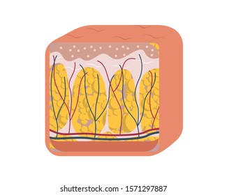 Cellulite formation vector illustration diagram, medical information scheme. Womans skincare.