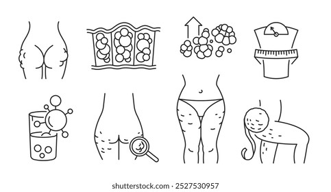 Conjunto de ícones da estrutura de tópicos da celulite. Coleção de pictogramas de lipodistrofia gineoide. Símbolo de adiposis edematosa. Traçado editável. Médico, conceito de saúde. Ilustração vetorial isolada em um fundo branco