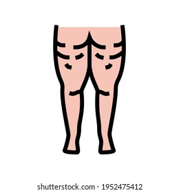 cellulite problem color icon vector. cellulite problem sign. isolated symbol illustration