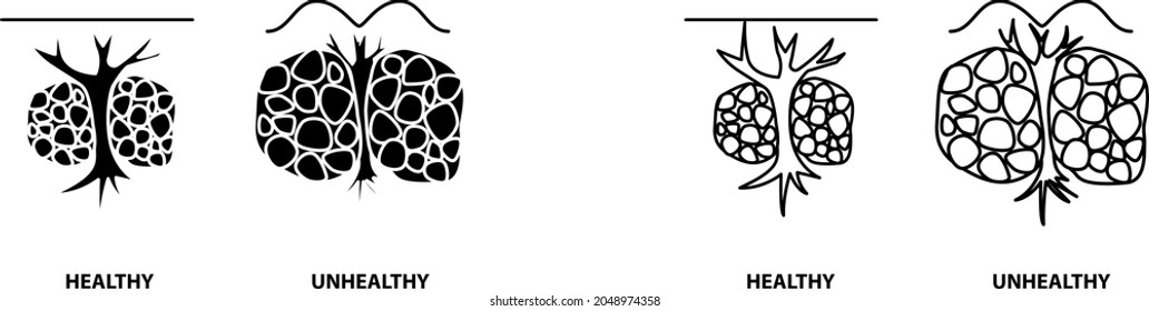 Cellulite reduction icon , vector illustration