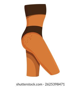 Cellulite skin on woman legs and buttocks, body positive and self acceptance concept