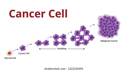 Cencer Cell Stage, Process, Development , Vector