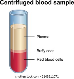 Zentrifugierte Blutprobe. Vektorgrafik.