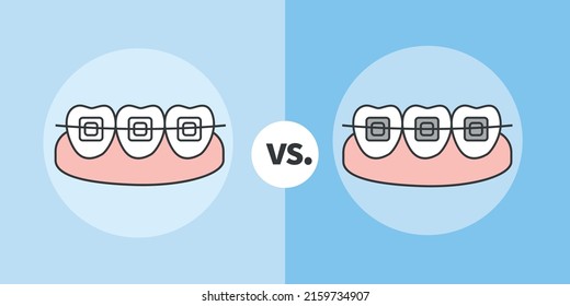 Ceramic Braces Vs Metal Braces, Orthodontist vector illustrator
