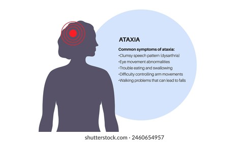 Cerebellar ataxia medical poster. Degenerative disease of the nervous system. Slurred speech, stumbling, falling, lack of coordination. Poor muscle control, clumsy movements flat vector illustration