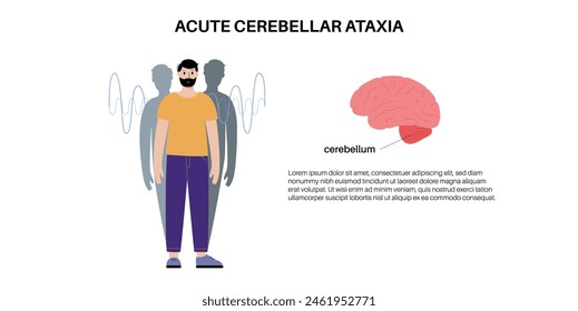 Cartel médico de ataxia cerebelosa. Enfermedad degenerativa del sistema nervioso. Habla arrastrada, tropiezos, caídas, falta de coordinación. Control muscular deficiente, movimientos torpes Ilustración vectorial plana