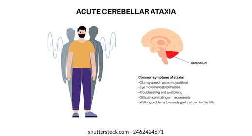 Cerebellar ataxia medical poster. Degenerative disease of the nervous system. Slurred speech, stumbling, falling, lack of coordination. Poor muscle control, clumsy movements flat vector illustration