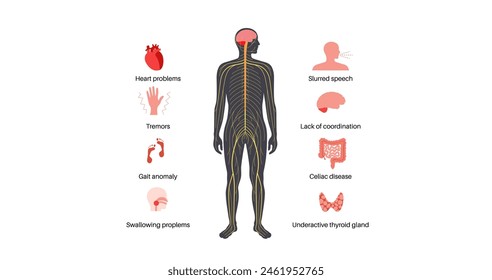 Cerebellar ataxia poster. Degenerative disease of the nervous system, main symptoms. Slurred speech, stumbling, falling, lack of coordination. Poor muscle control, clumsy movements vector illustration