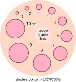 Cervial Dilation Scale with pink circles. Cervical board. Shows how cervix is opening during delivery process. Medical Illustration chart in centimeters. Isolated on white background.