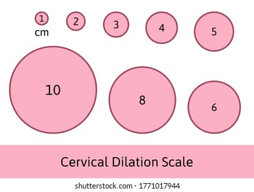 Cervial Dilation Scale with pink circles. Shows how cervix is opening during delivery process. Medical Illustration chart in centimeters. Isolated on white background.