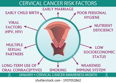 Cervical Cancer Disease Risk Factors Infographic Vector Illustration. Diagnosis, Prevention, Symptoms, And Treatment Concept. Flat Style Medical Template. Hand-drawn Awareness Month,and Health Design.