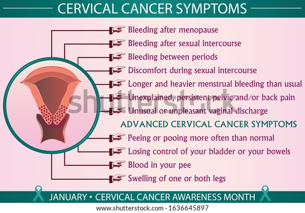 Cervical Cancer Disease Symptoms Infographic Vector Stock Vector ...