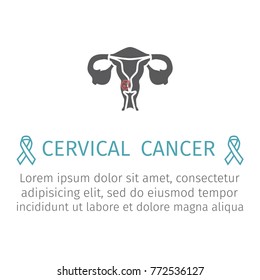 Cervical cancer. Flat illustration, vector