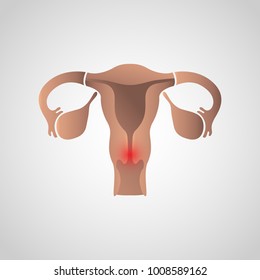 Cervical Cancer Icon Design, Infographic Health. Vector Illustration.