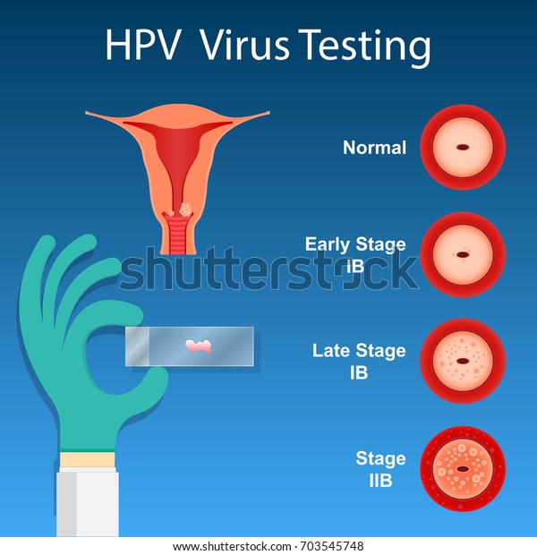 Cervical Cancer Screen Testing Examine Doctor Stock Vector Royalty Free 703545748