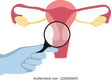 cervical cancer screening concept. doctor hand