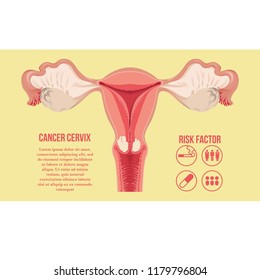 CERVICAL CANCER VECTOR