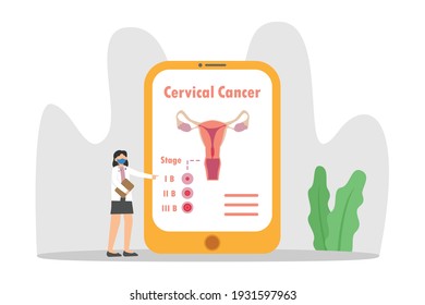 Cervical cancer vector concept: Female doctor showing stages of cervical cancer on a big screen while wearing face mask