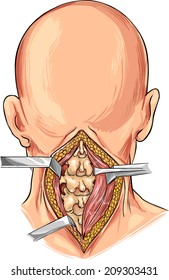 Cervical Spine illustration