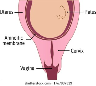 Cervix is not effaced. First stage of delivery process. cervix is tightly closed and protected. Uterus with baby or fetus inside. Medical vector illustration isolated on white.