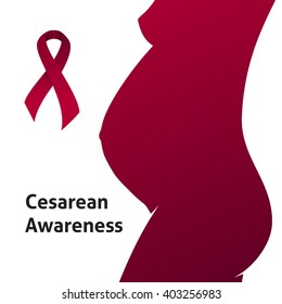 Cesarean Awareness Month Poster. Awareness Ribbon and Pregnant Woman on White Background. Medical Cesarean Section Awareness Design Template. Illustration for C-Section Information Flyer.
