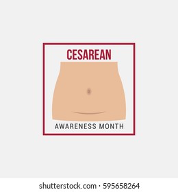 Cesarean Awareness Month Vector Illustration. Suitable for Greeting Card, Poster and Banner.