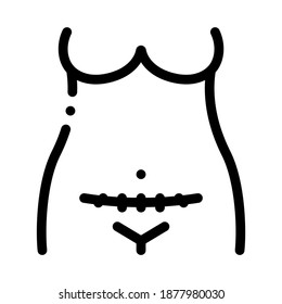 Cesarean Section Black Icon Vector. Cesarean Section Sign. Isolated Symbol Illustration