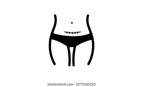 cesarean section, black isolated silhouette