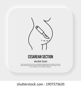 Cesarean Section Thin Line Icon. Scalpel Near Belly. Surgical Operation For Childbirth. Vector Illustration.