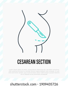 Cesarean section thin line icon. Scalpel near belly. Surgical operation for childbirth. Vector illustration.