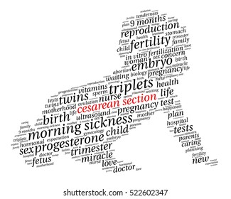 Cesarean section. Word cloud, baby silhouette, italic font, white background. The miracle of birth.