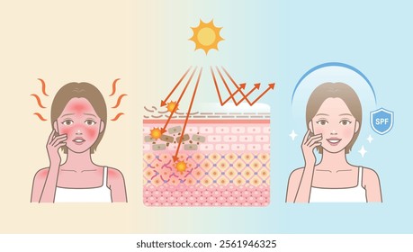 The changes of skin structure damaged by sunlight(before and after comparison). Skin layer vector illustration. Skin anatomy